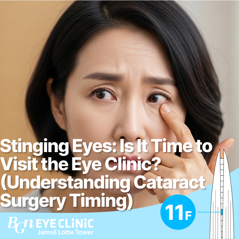 Stinging Eyes: Is It Time to Visit the Eye Clinic? (Understanding Cataract Surgery Timing)